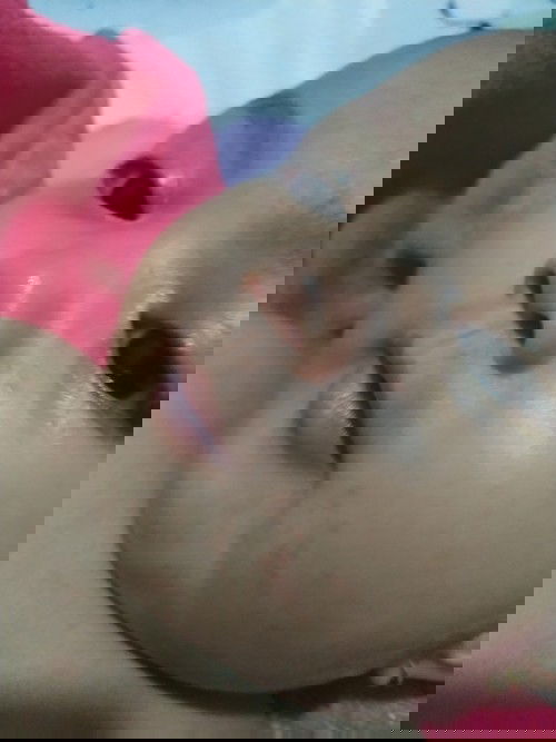 Bruntusan di muka setelah Mpasi