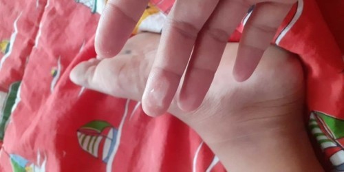 มูกใสออก3วันแล้วจ้าา