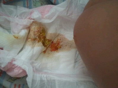 whats in my baby's poo?