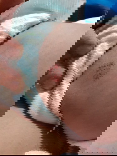 SKIN PROBLEMS
