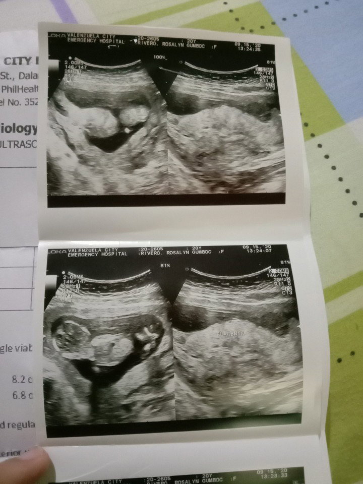 13weeks and 1day as of September 15 !!
