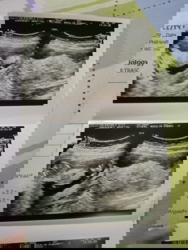 13weeks and 1day as of September 15 !!