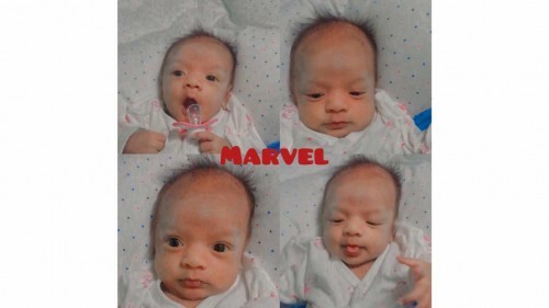 เด็กคลอดกำหนดในวันนั้นสู่เด็กทะเล้นในวันนี้