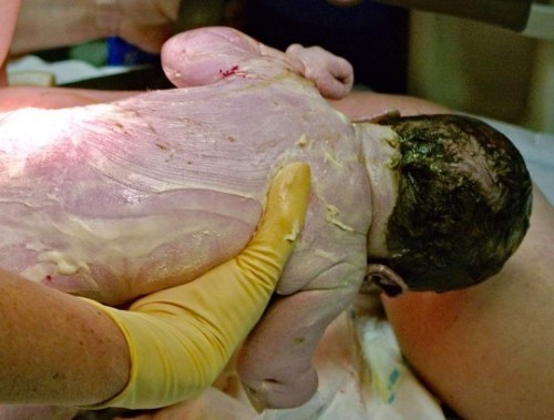 FUNGSI VERNIX CASEOSA