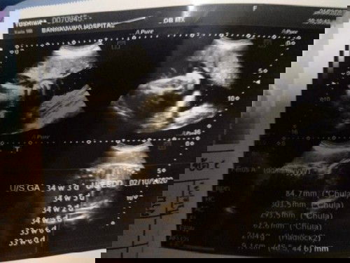 คุณแม่ท่านไหนมีใครดูเป็นไหมคะ ว่าตรงนี้คือส่วนไหน พอดีท้องแรกคะ