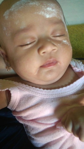 Bayi sering kentut