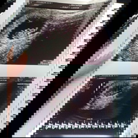 Drama flek berminggu2