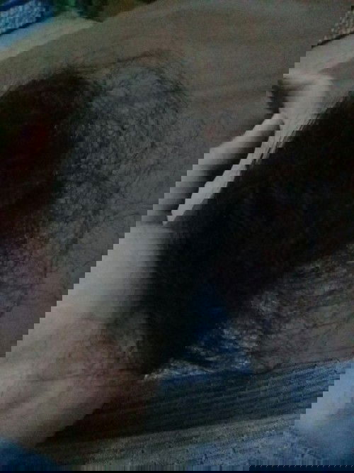 cara mengatasi rambut rontok berlebih saat selesai melahirkan