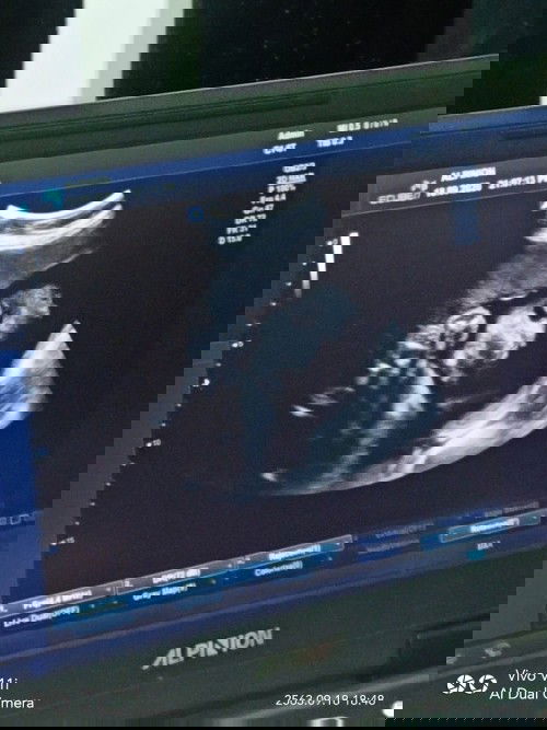 7เดือนแร้วนะ