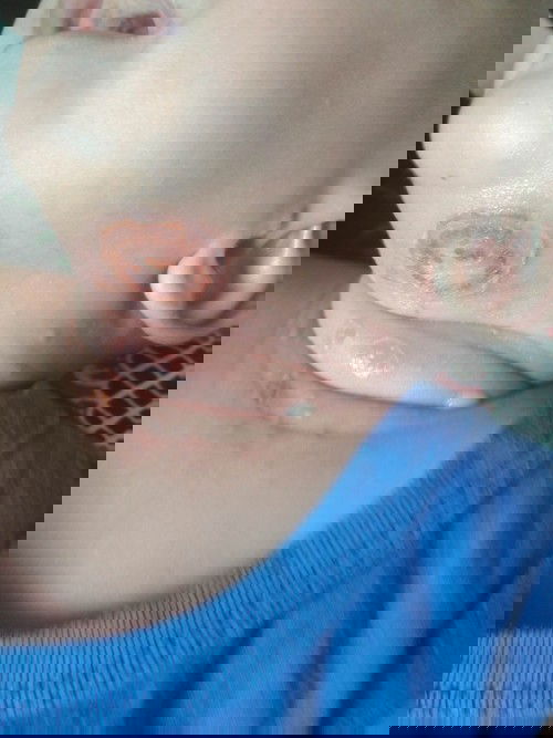 Penyakit apa ya bun ?