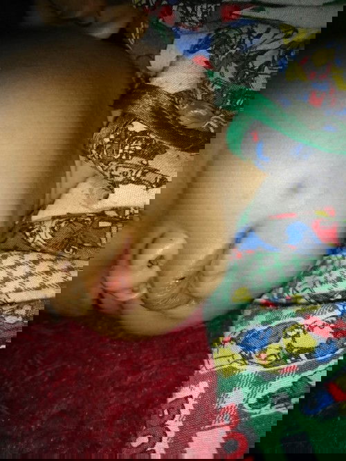 Bibir sariawan dan kering