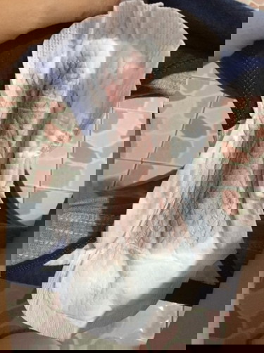 สอบถามแม่ๆที่ผ่าคลอด