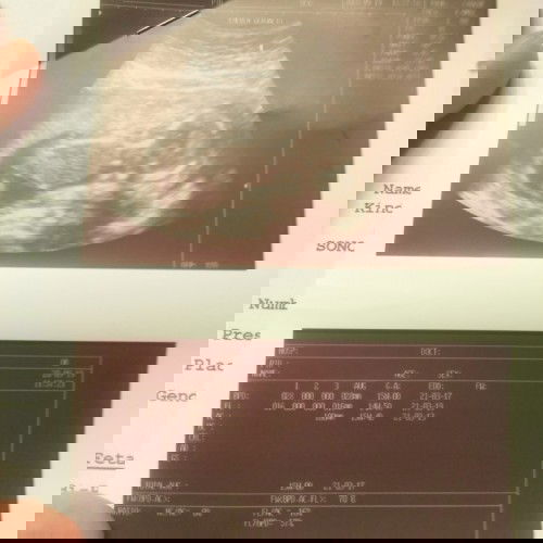 Nakampante na ako dhl nrinog ko na heart beat ni baby 15 weeks kakaultrasound ko lng  kahapon 😘😊