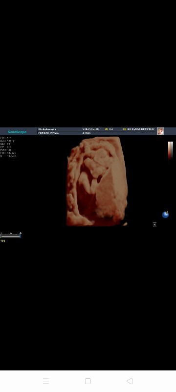 Baru setahun lalu hamil tahun ini di kasih malaikat kecil lagi.