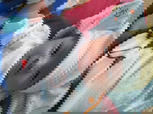 khò khè khó thở