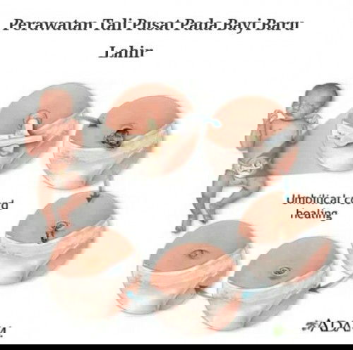 Perawatan tali pusat