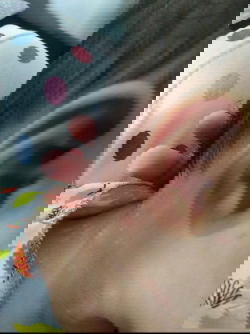 bercak putih di leher