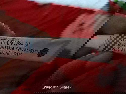 Worry karna sudah 5 bulan menggunakan salep ini