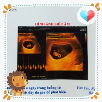 Các mom cho e hỏi bầu 7tuần 4ng uống sắt loại nào được ạ