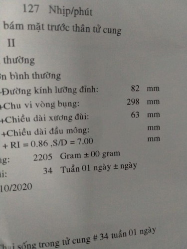 Trong giây siêu âm là vày mà theo thông tin trang bà bầu thì chiều dài từ đầu tới gót chân 45- 47