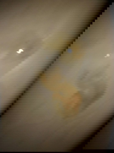 DISCHARGE WITH NO PAIN