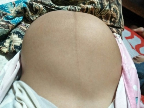 Malapit napo siguro manganak no kapag ganto panay naninigas na yung Tummy? 😯