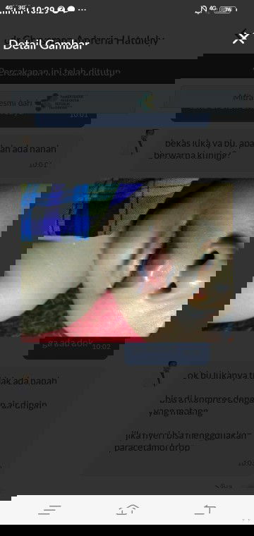 Bibir bayi 8 bulan luka terkena lantai