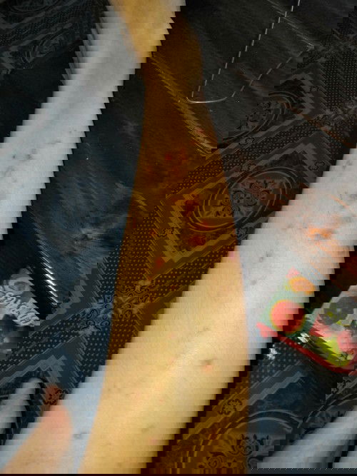 คันช่วงไตรมาสสุดท้าย