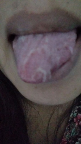 Usia khmilan sya 29w,obat panas dlam utk ibu hamil apa ya.lidah sya smpe pd putih" kya gtu perih๐