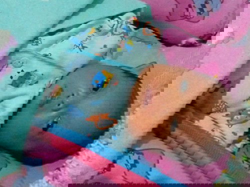 Bintik2 di wajah bayi