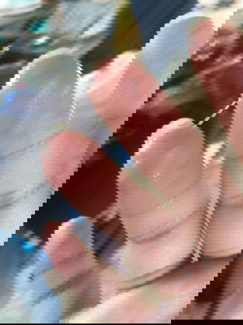 ท้องแรกคะมันคืออะไร