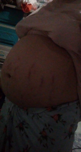 Baby bump #TeamNovember