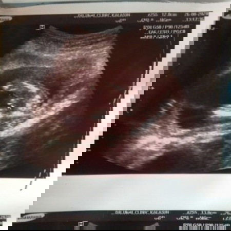 แม่ๆได้ลูกเพศไหนกันบ้างเอ่ย บ้านนี้ซาวด์ตอน16 w+6 จู๋ชัดมากค่ะของดูในซาวด์ขอแม่ๆหน่อยค่ะ