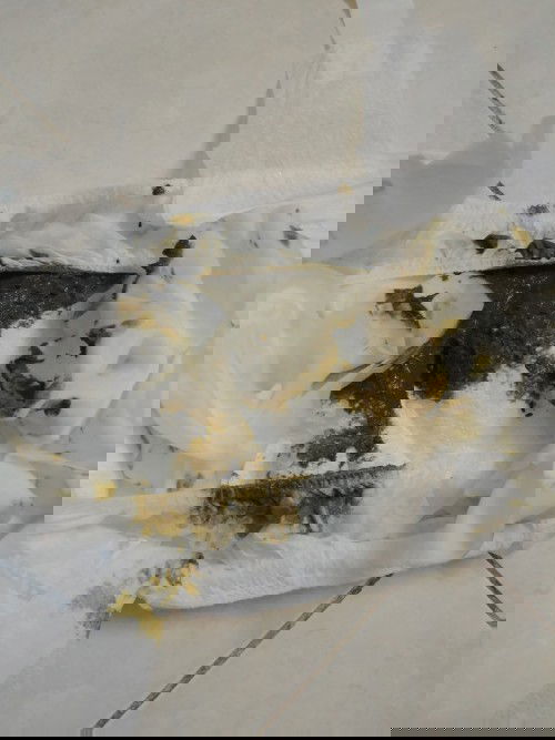 Mau phân của trẻ