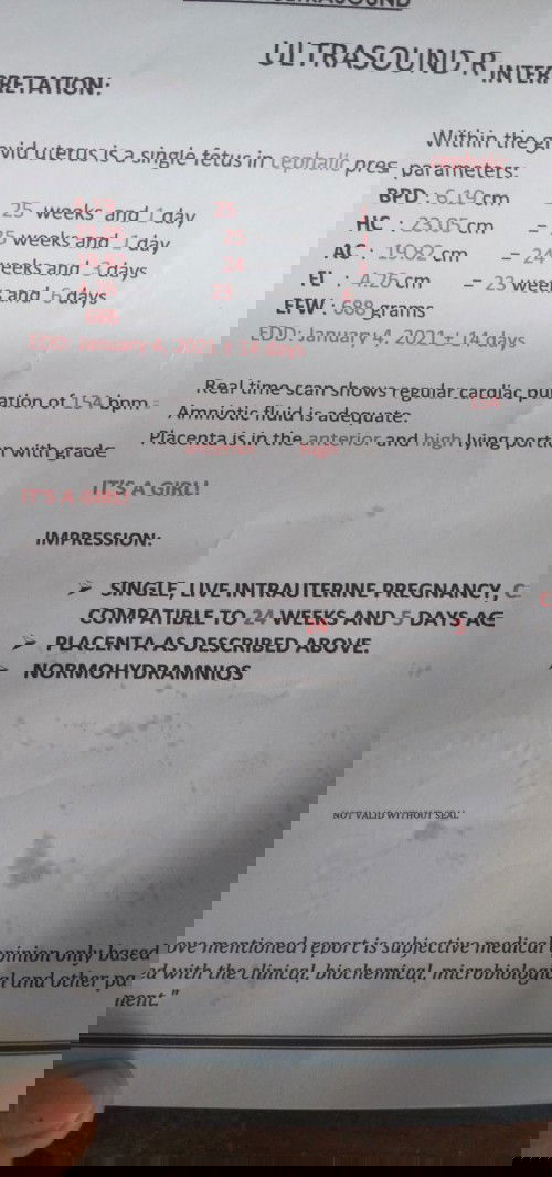 Normal lang po ba to?