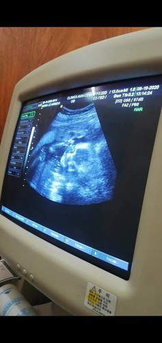 Cas ultrasound!