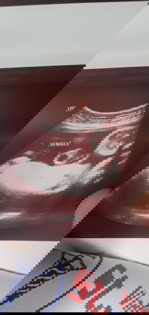 Hi mga ka october ♥️ Ready napo ba ang hospital bag at baby essential nyo pasilip naman po 😍