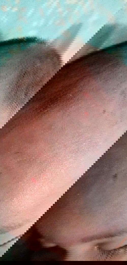 Garuk Nya Kuat Banget