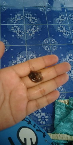 แบบนี้อันตรายไหมคะท้องแรก
