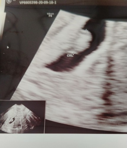 Normal atau abnormal