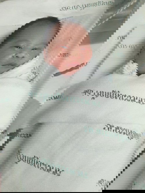 ตั้งครรภ์ 41วีค เร่งคลอด