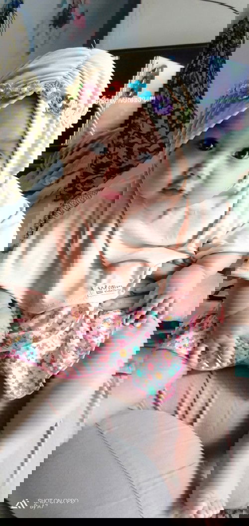 bayi garuk2 sampe lecet