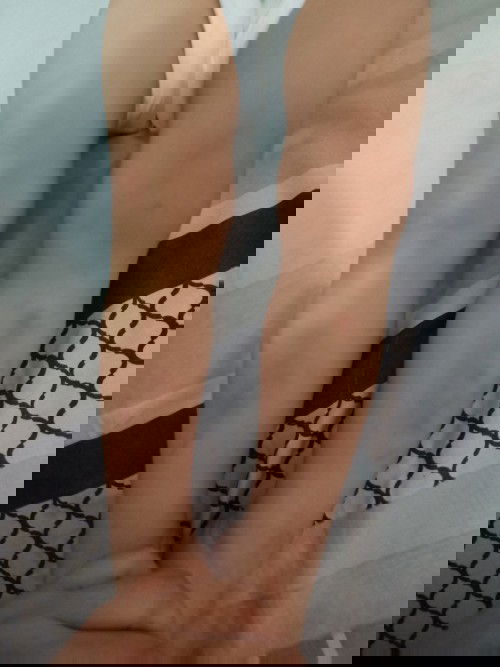 cara menghilangkan bkas luka