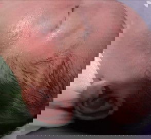 Melenting Di Wajah Baby New Born