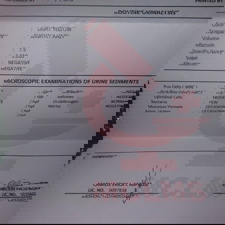 Normal Lang po ba result ko ???