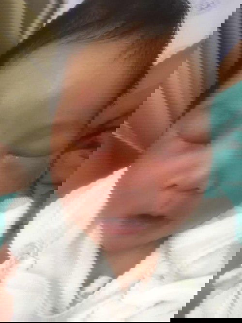 สอบถามค่ะแม่ค่ะ หัวน้องปูดออกเป็นแบบนี้