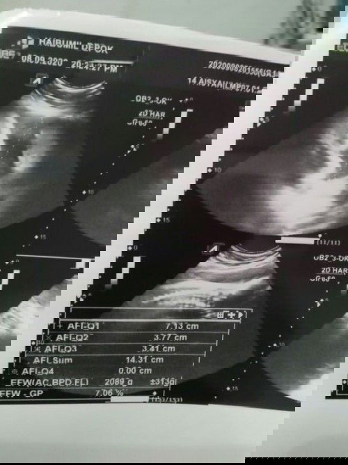 Alhamdulillah, MasyaAllah Tabarakallah (23 September 2020)