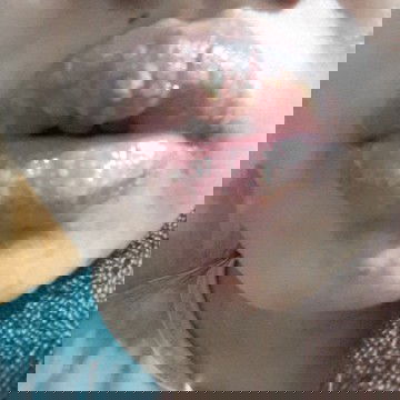 bibir bengkak,perih dan luka