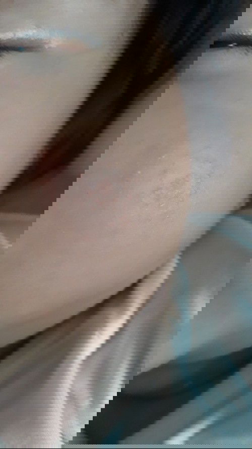 Câu hỏi tư vấn các mẹ
Bé nhà mình bị nổi. Bôi thuốc gì cho hết. Nhờ các mẹ tue vấn giúp mình