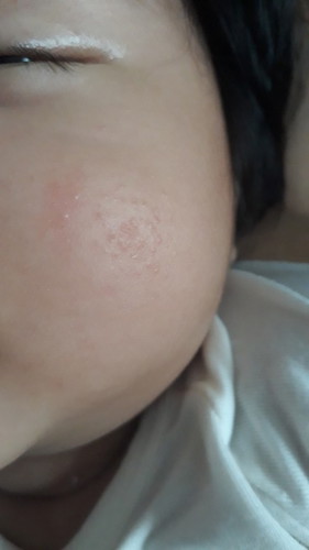 Câu hỏi tư vấn các mẹ
Bé nhà mình bị nổi. Bôi thuốc gì cho hết. Nhờ các mẹ tue vấn giúp mình